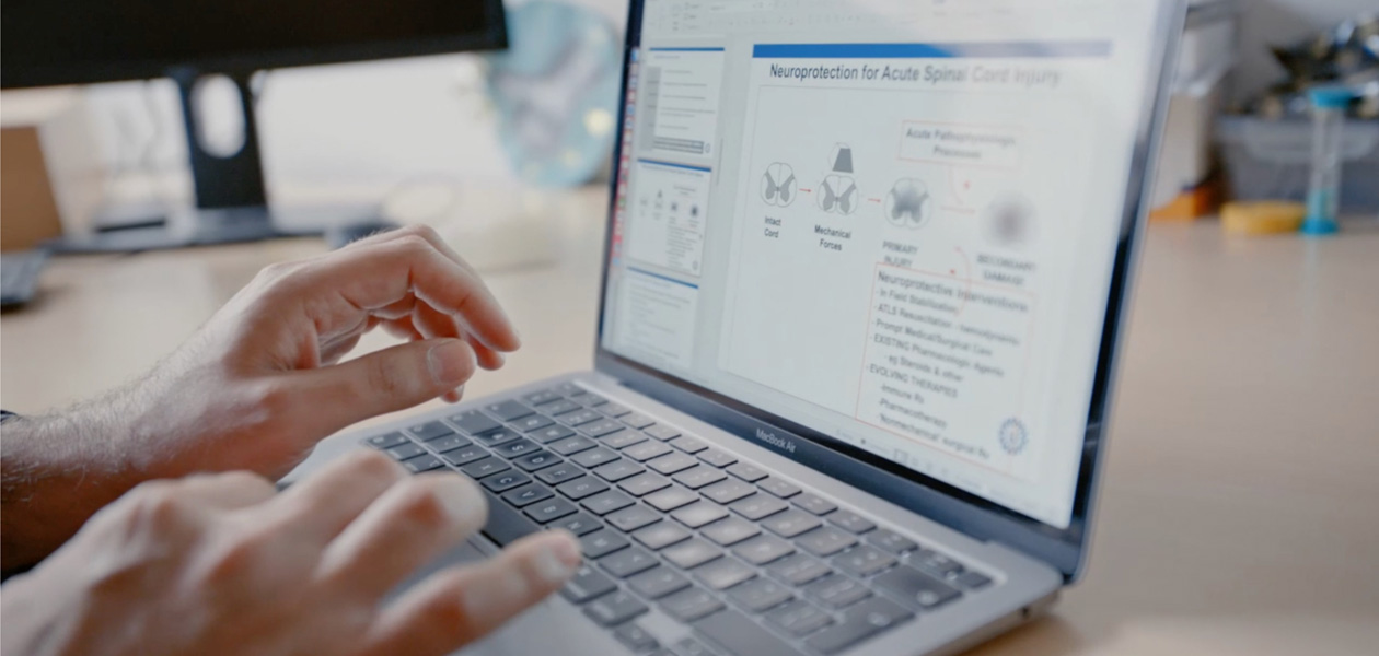 Hände tippen auf einem MacBook Pro.